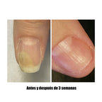 NAILSOFTHEDAY Onistop. Aceite de cuidado intensivo para uñas y cutículas