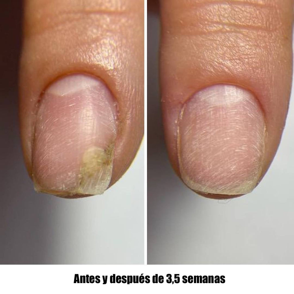 NAILSOFTHEDAY Onistop. Aceite de cuidado intensivo para uñas y cutículas