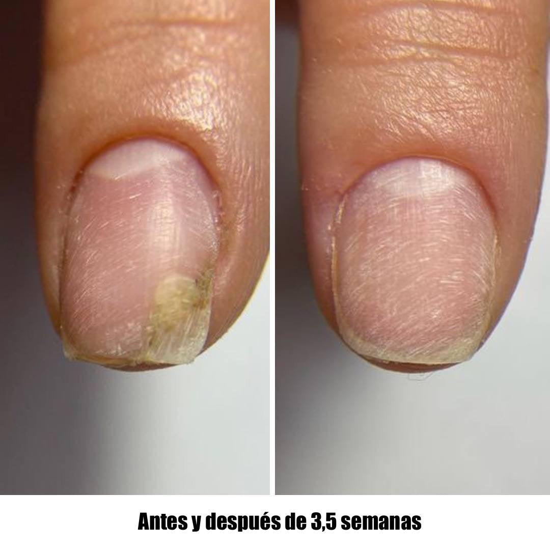 NAILSOFTHEDAY Onistop. Aceite de cuidado intensivo para uñas y cutículas