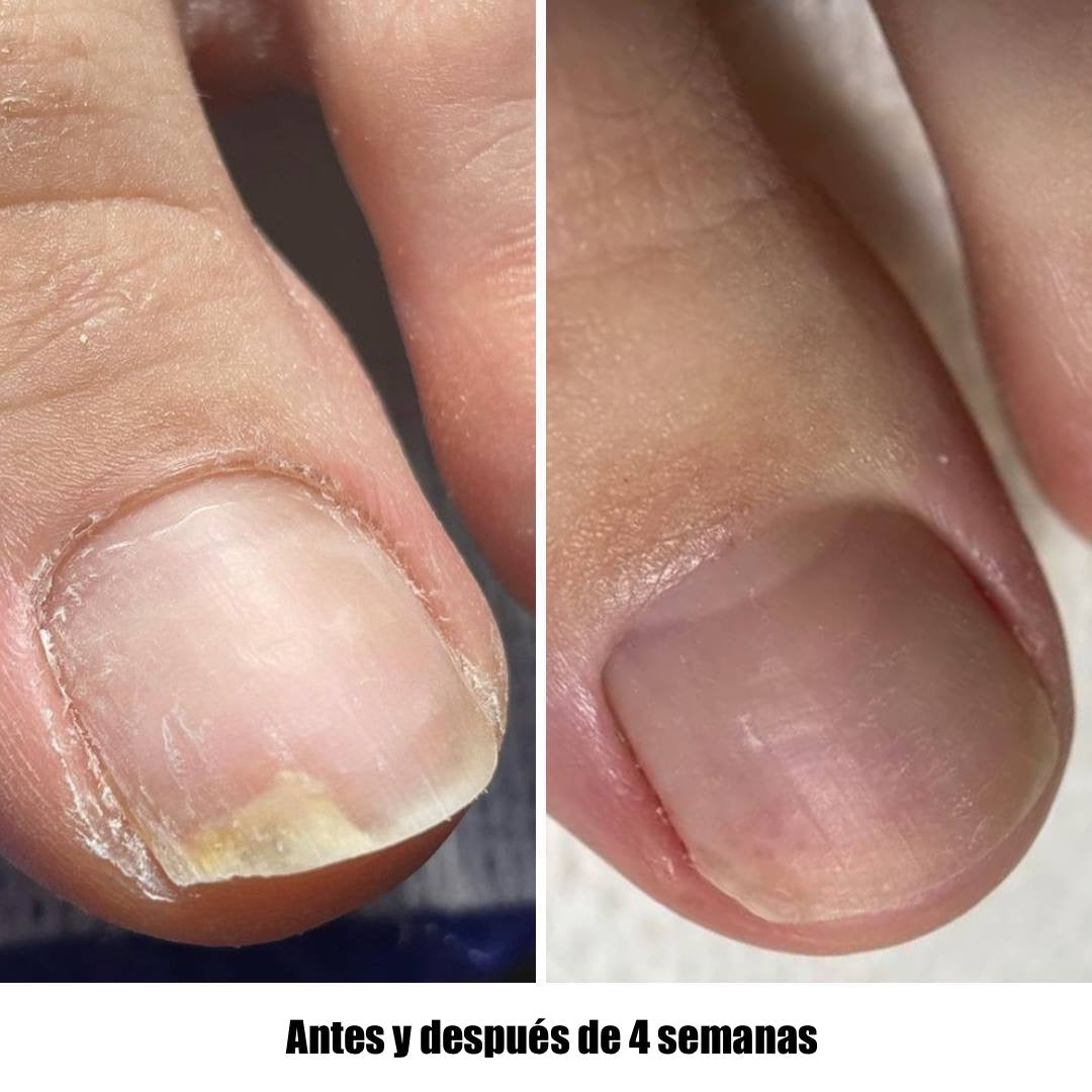NAILSOFTHEDAY Onistop. Aceite de cuidado intensivo para uñas y cutículas