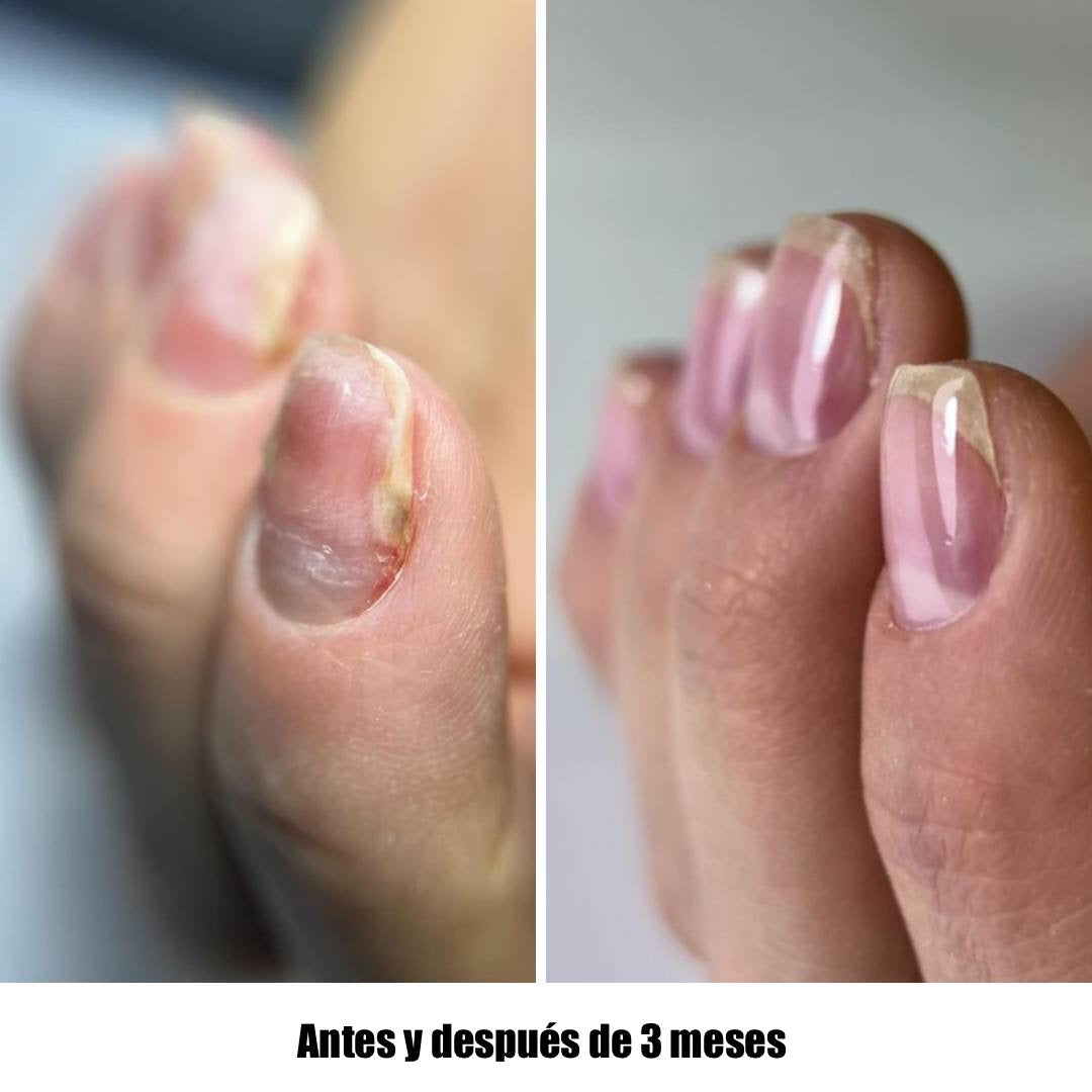 NAILSOFTHEDAY Onistop. Aceite de cuidado intensivo para uñas y cutículas