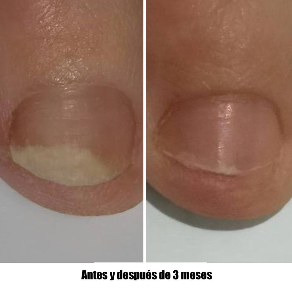 NAILSOFTHEDAY Onistop. Aceite de cuidado intensivo para uñas y cutículas