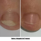 NAILSOFTHEDAY Onistop. Aceite de cuidado intensivo para uñas y cutículas