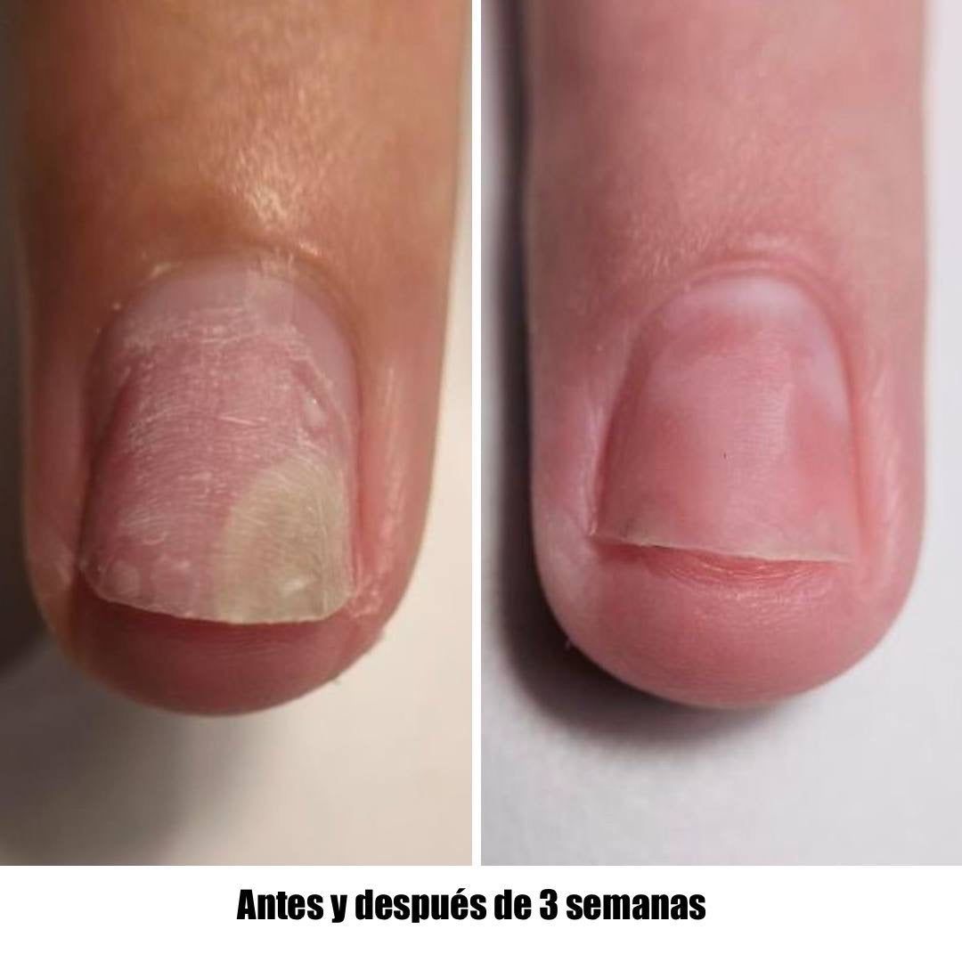 NAILSOFTHEDAY Onistop. Aceite de cuidado intensivo para uñas y cutículas