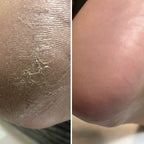Resultum Anti Crack Cream Jojoba – Crema reparadora para grietas en manos y pies con aceite de jojoba