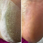 Resultum Anti Crack Cream Jojoba – Crema reparadora para grietas en manos y pies con aceite de jojoba