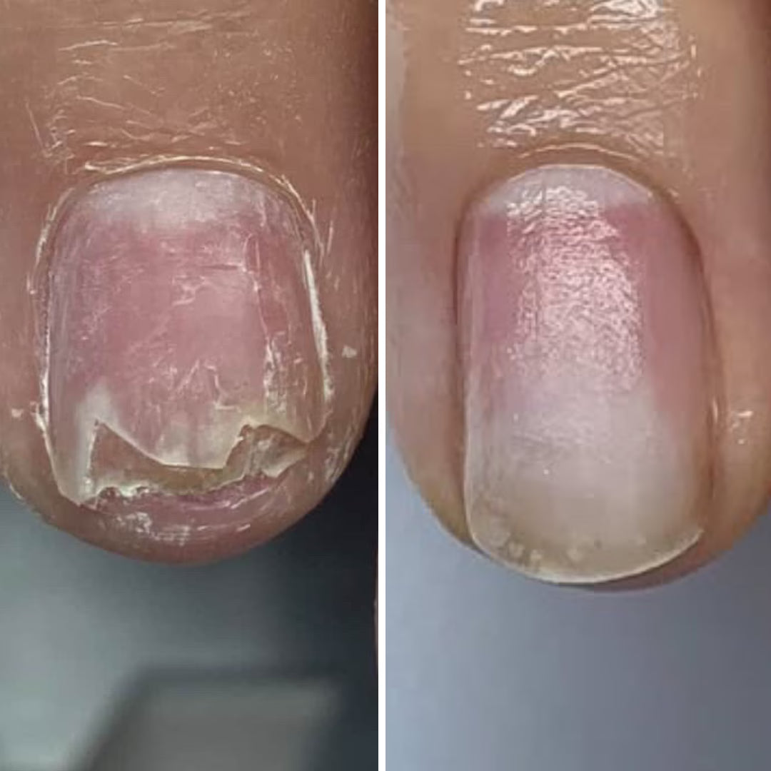 Resultum Onistopix Lotion – Loción regeneradora para uñas