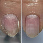 Resultum Onistopix Lotion – Loción regeneradora para uñas