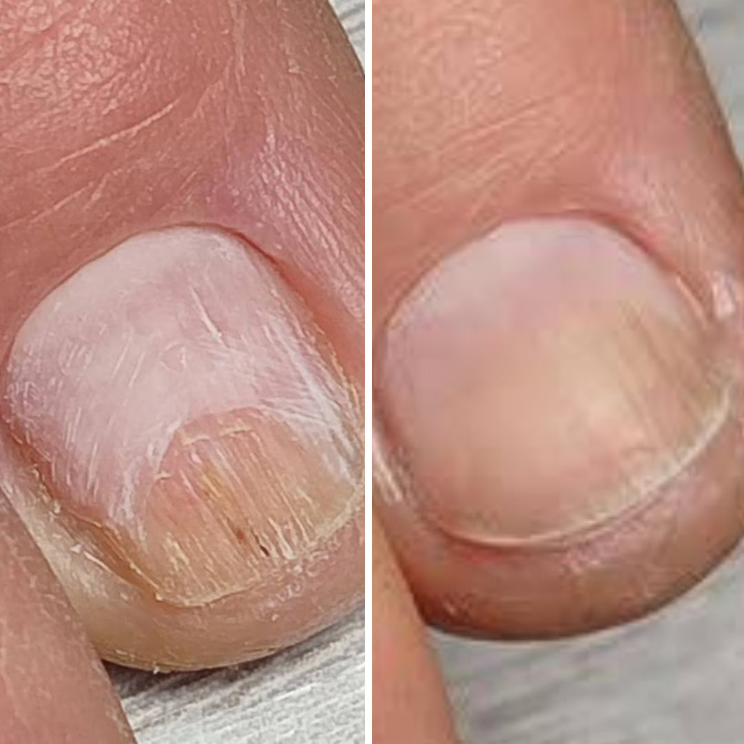 Resultum Onistopix Lotion – Loción regeneradora para uñas