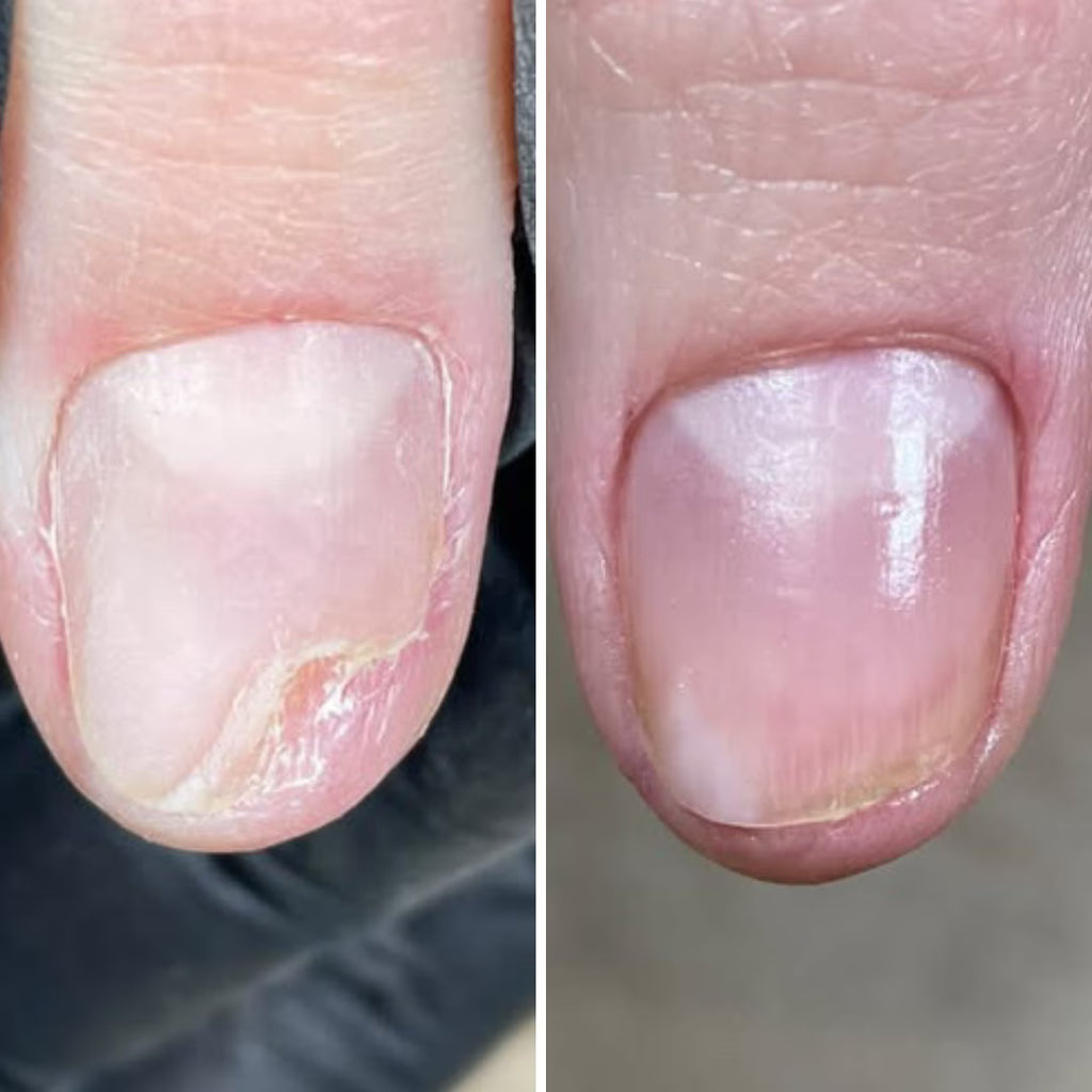 Resultum Onistopix Lotion – Loción regeneradora para uñas