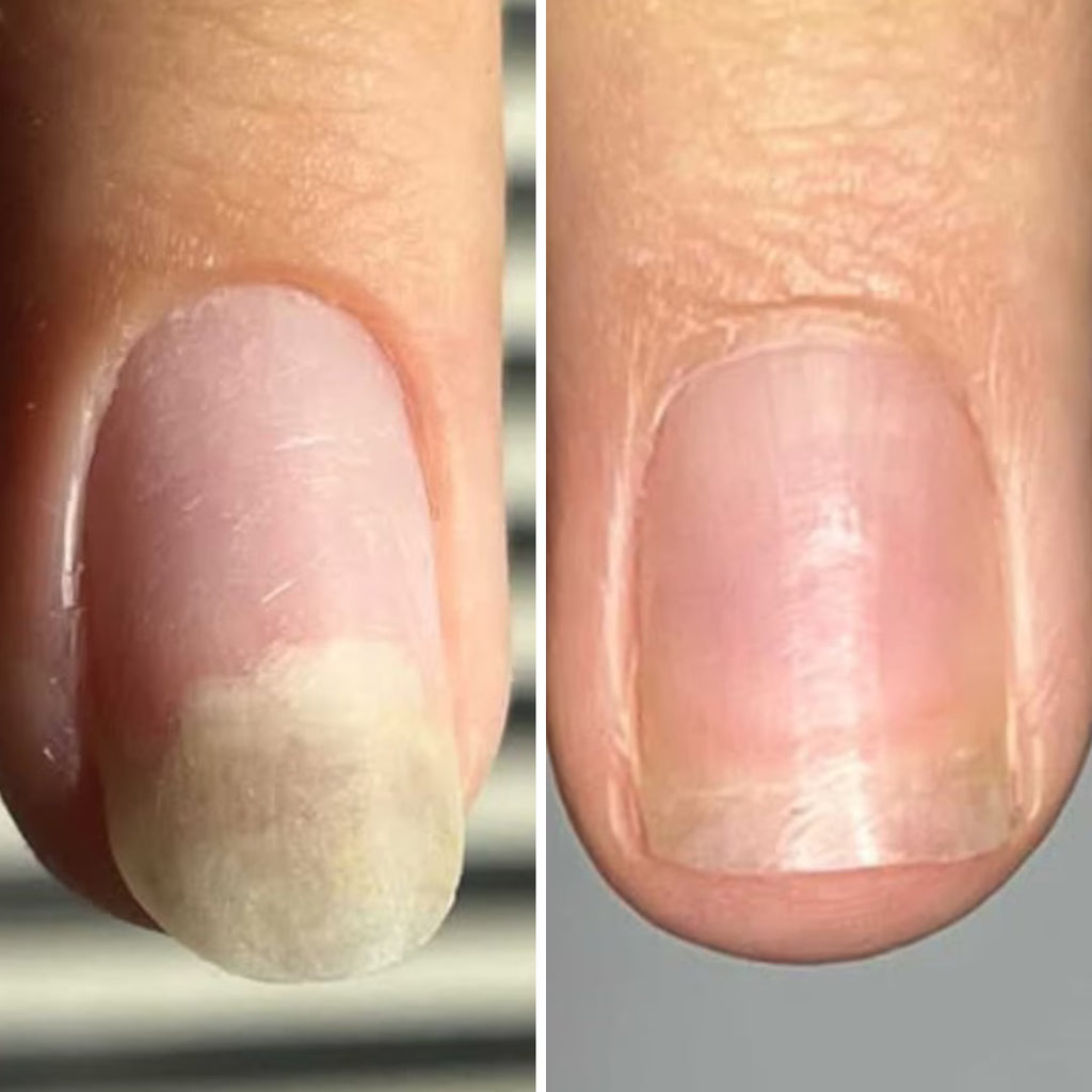 Resultum Onistopix Oil – Aceite regenerador para uñas y cutículas