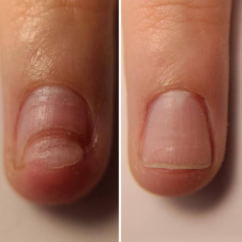 Resultum Onistopix Oil – Aceite regenerador para uñas y cutículas