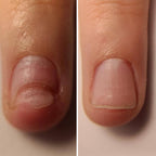 Resultum Onistopix Oil – Aceite regenerador para uñas y cutículas
