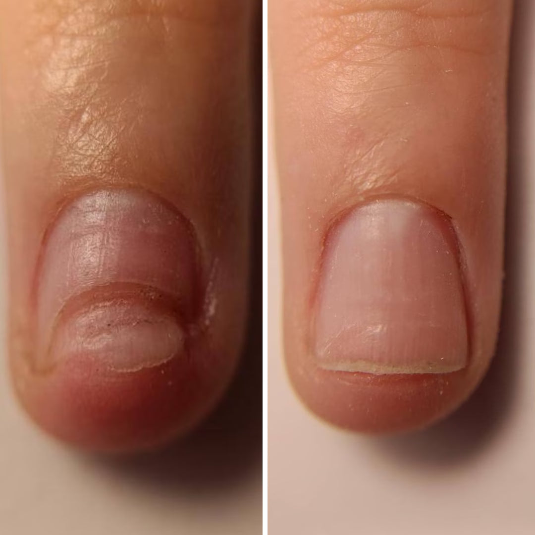 Resultum Onistopix Oil – Aceite regenerador para uñas y cutículas