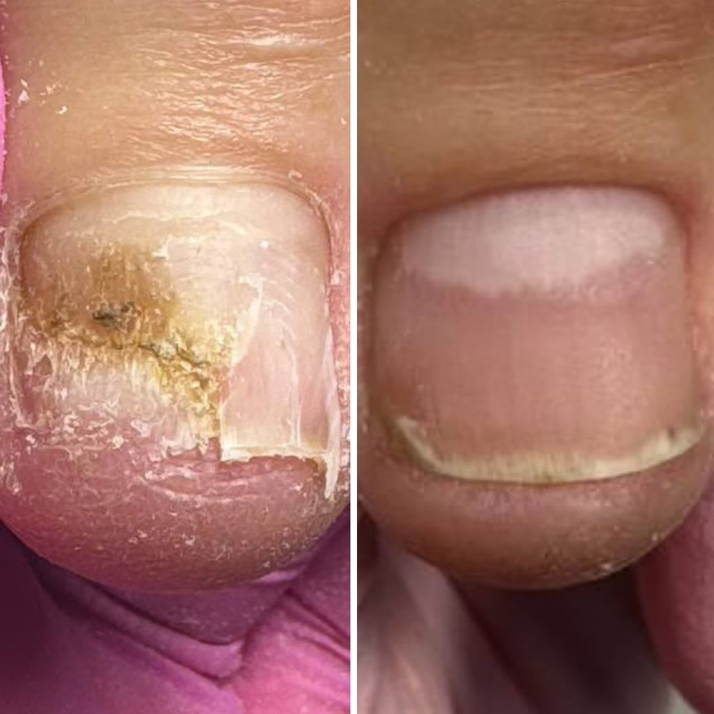 Resultum Onistopix Oil – Aceite regenerador para uñas y cutículas
