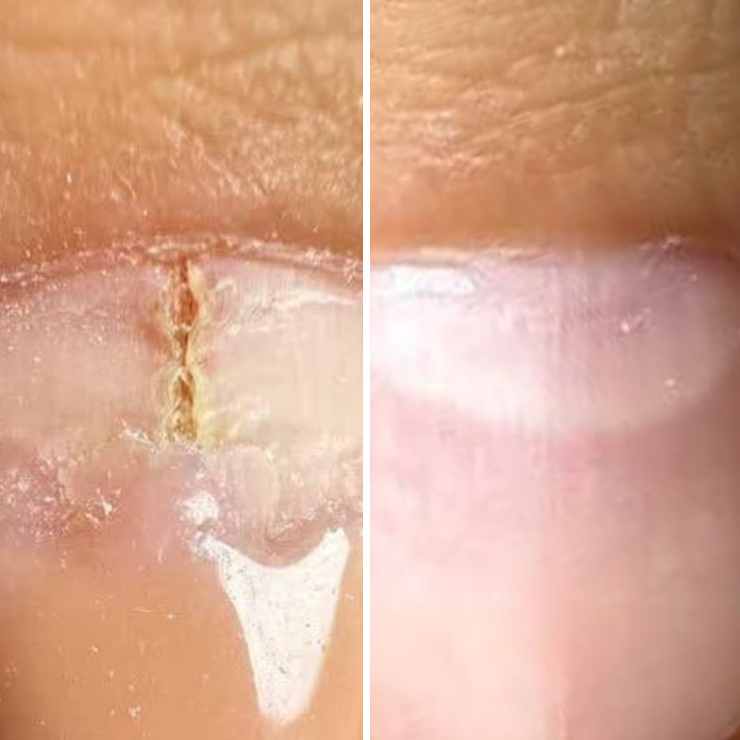 Resultum Onistopix Oil – Aceite regenerador para uñas y cutículas