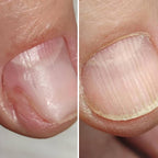 Resultum Onistopix Oil – Aceite regenerador para uñas y cutículas
