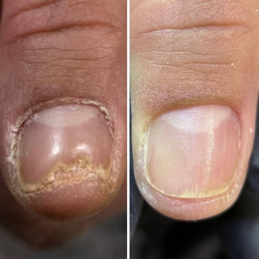 Resultum Onistopix Oil – Aceite regenerador para uñas y cutículas