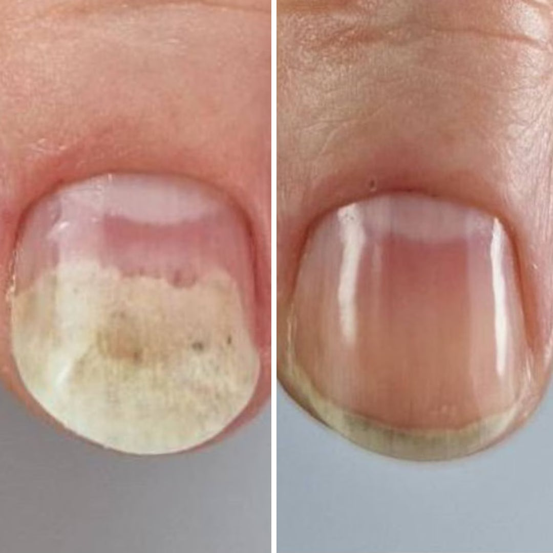 Resultum Onistopix Oil – Aceite regenerador para uñas y cutículas