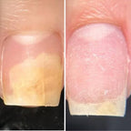 Resultum Onistopix Oil – Aceite regenerador para uñas y cutículas