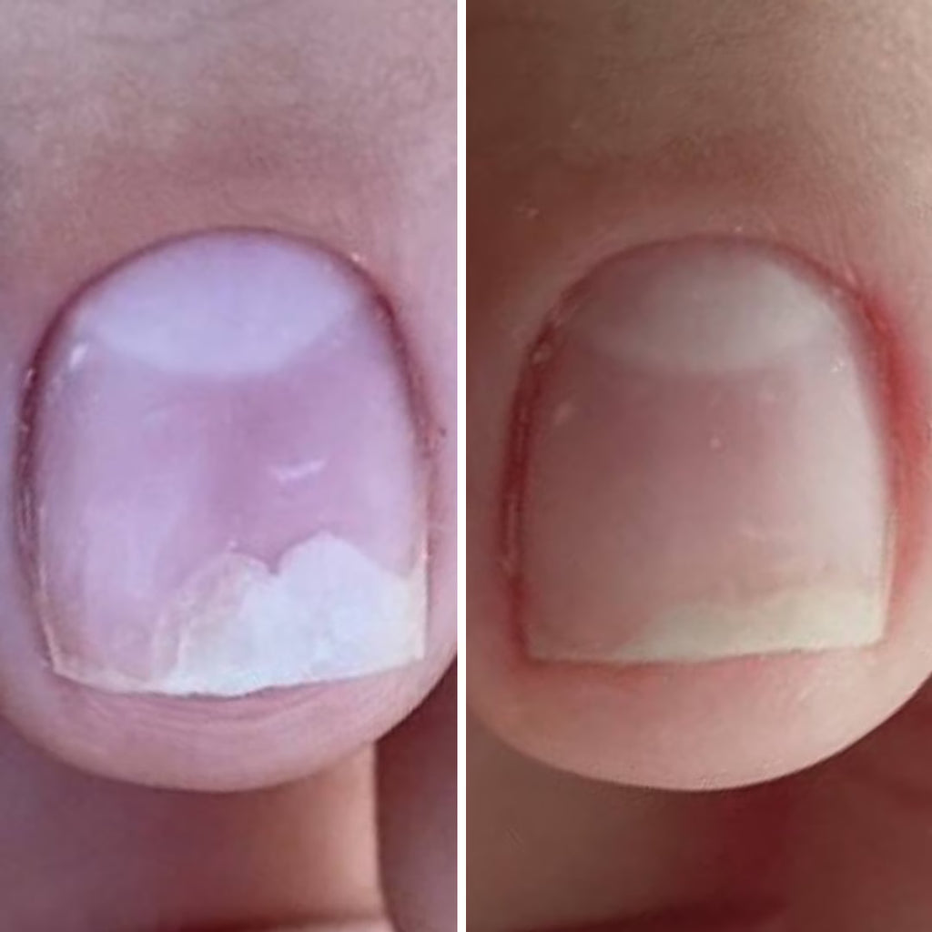 Resultum Onistopix Oil – Aceite regenerador para uñas y cutículas