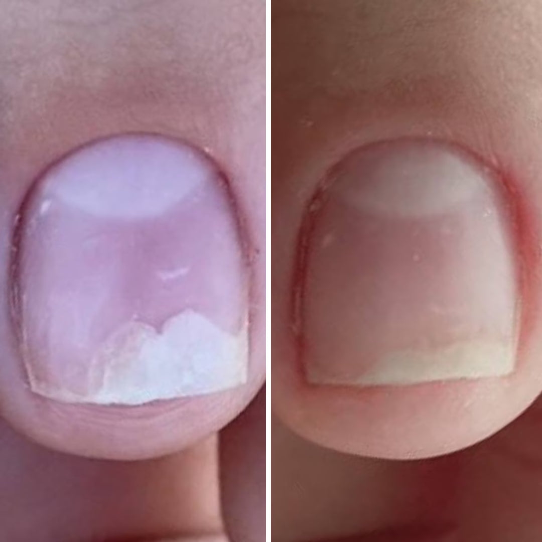 Resultum Onistopix Oil – Aceite regenerador para uñas y cutículas