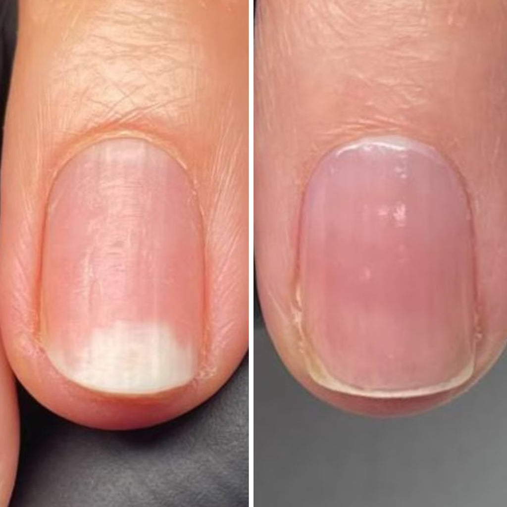 Resultum Onistopix Oil – Aceite regenerador para uñas y cutículas