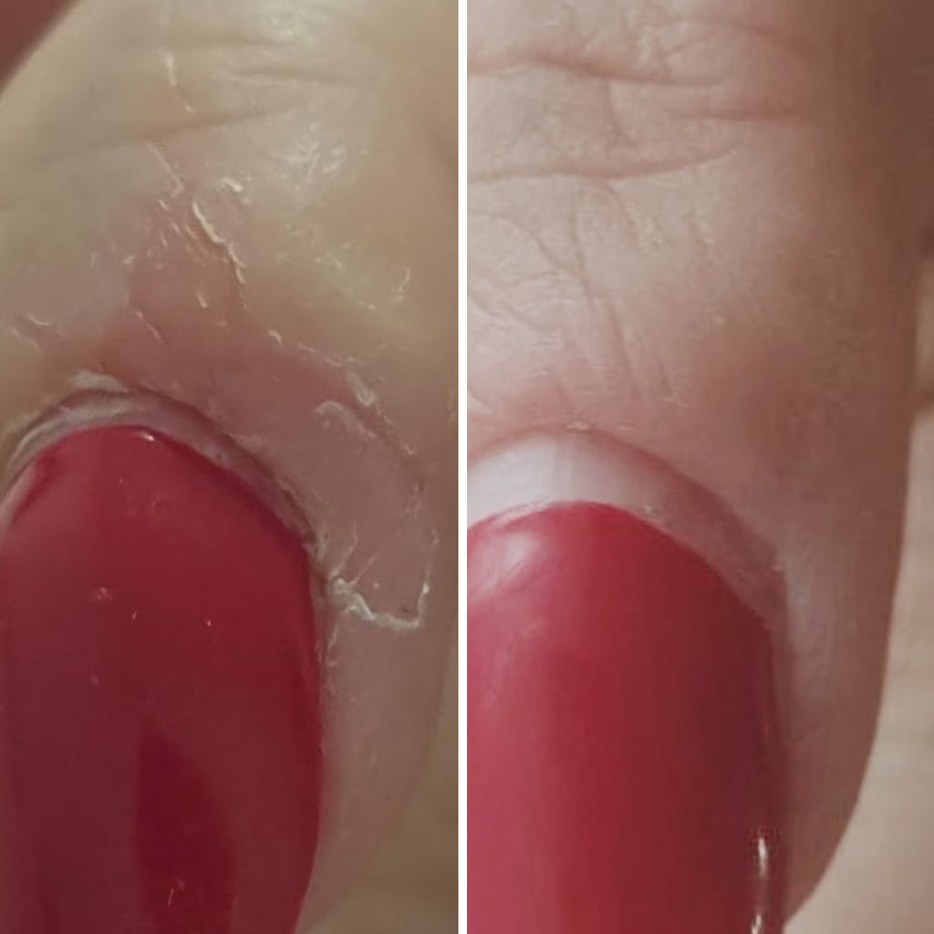 Resultum Onistopix Lotion – Loción regeneradora para uñas